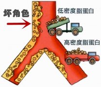 中药膏滋生产厂家：血脂异常患者如何进行饮食管理