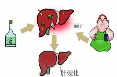 养肝膏滋贴牌代理：脂肪肝该怎么调理？